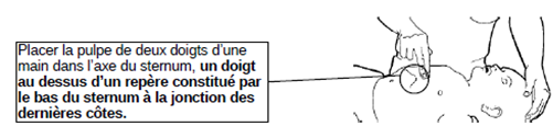 diagrama de compresión torácica en bebés